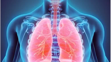 Lung Diseases